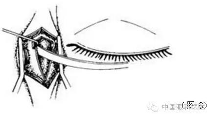 ͼ����⣺����ժ����