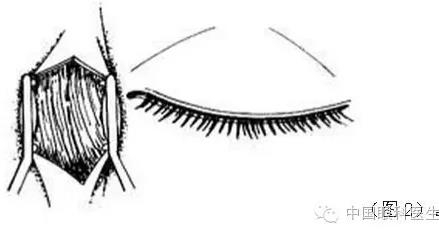 ͼ����⣺����ժ����