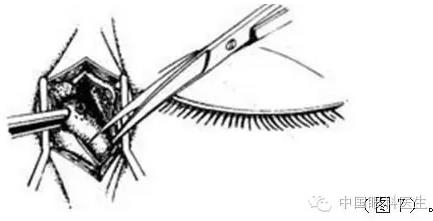 ͼ����⣺����ժ����