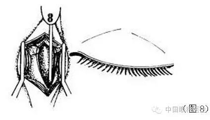 ͼ����⣺����ժ����