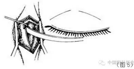 ͼ����⣺����ժ����