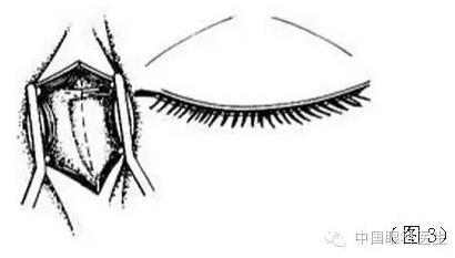 ͼ����⣺����ժ����