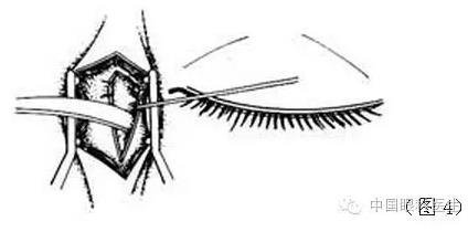 ͼ����⣺����ժ����