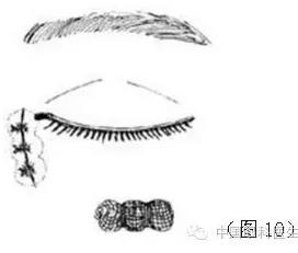 ͼ����⣺����ժ����