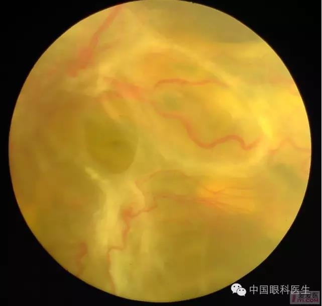 �����������۵ײ�ͼƬ��������ѧϰ�������Ĳ���ͼƬ��