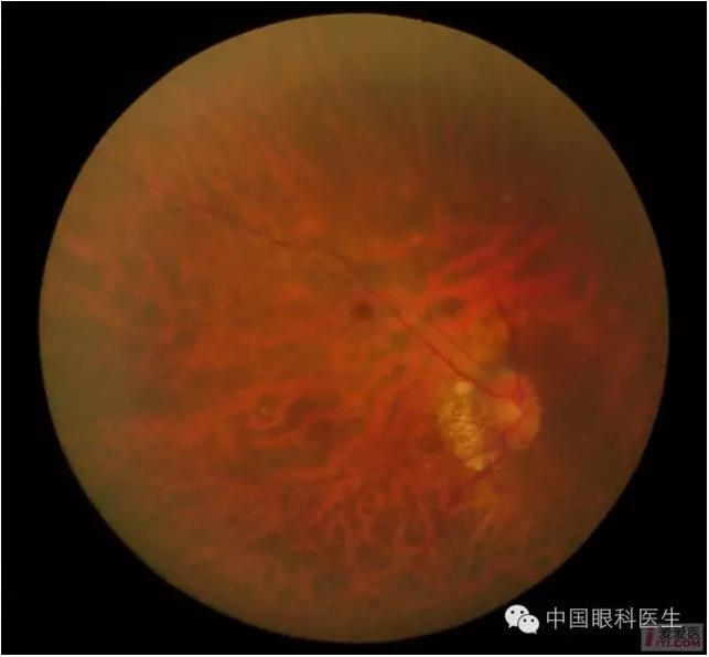 �����������۵ײ�ͼƬ��������ѧϰ�������Ĳ���ͼƬ��