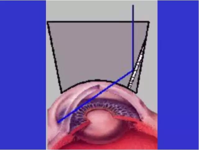 ǰ���Ǿ���鷨��PPT�棩