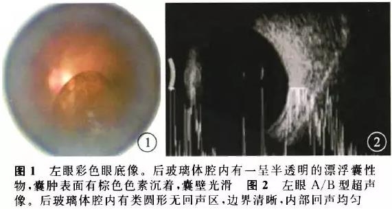 �������������Բ���������һ��