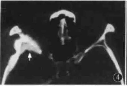 ͼ�Ľ�˵����η����ۿ�CTƬ