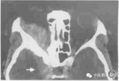 ͼ�Ľ�˵����η����ۿ�CTƬ