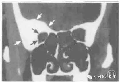 ͼ�Ľ�˵����η����ۿ�CTƬ