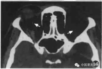 ͼ�Ľ�˵����η����ۿ�CTƬ