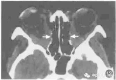 ͼ�Ľ�˵����η����ۿ�CTƬ