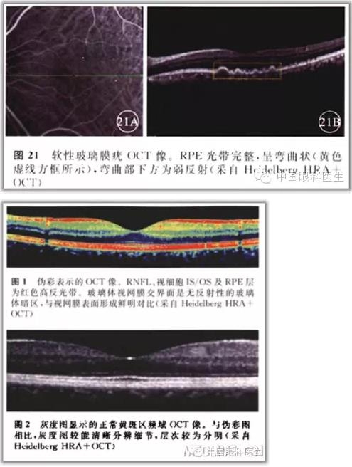 ����ɶϲ�ɨ����ͼ��ɼ����������