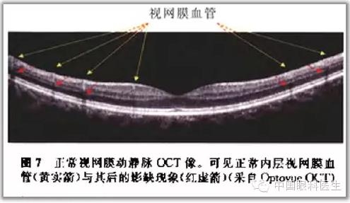 ����ɶϲ�ɨ����ͼ��ɼ����������