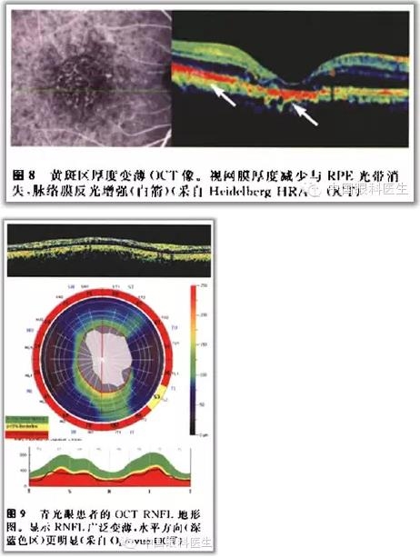 ����ɶϲ�ɨ����ͼ��ɼ����������