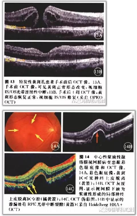 ����ɶϲ�ɨ����ͼ��ɼ����������