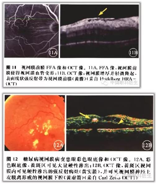 ����ɶϲ�ɨ����ͼ��ɼ����������