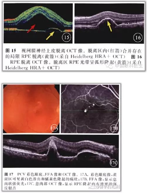 ����ɶϲ�ɨ����ͼ��ɼ����������