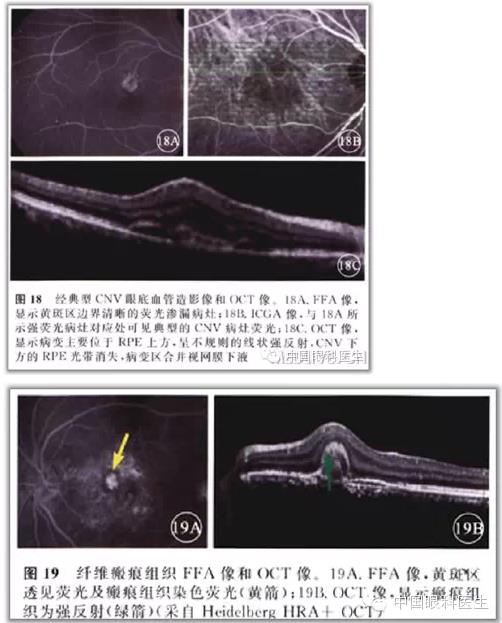 ����ɶϲ�ɨ����ͼ��ɼ����������