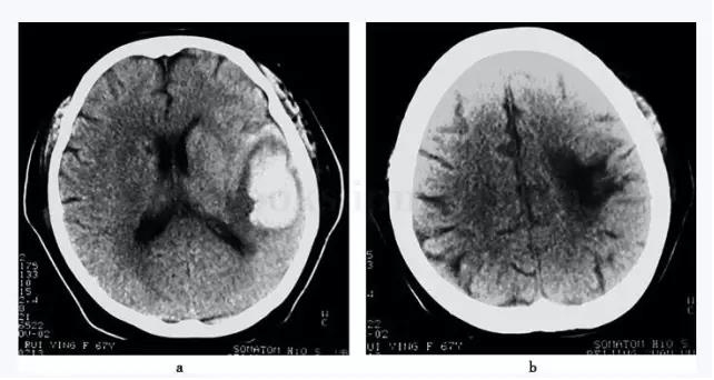 ��������������˫�����Ҳ�����12�죬���֫��鶯1��