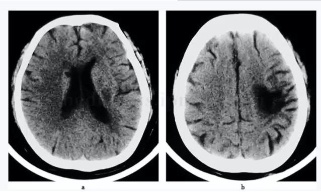 ��������������˫�����Ҳ�����12�죬���֫��鶯1��