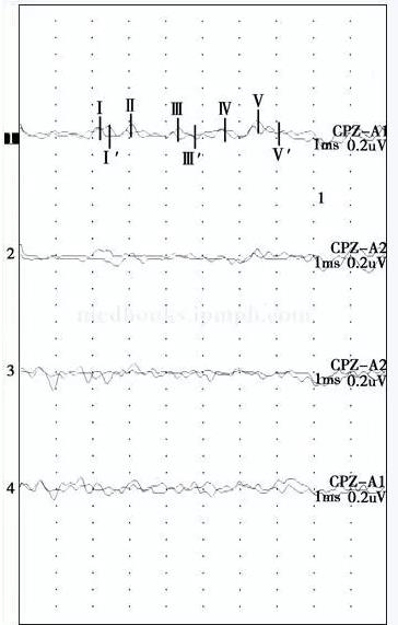 ��������������˫�����Ҳ�����12�죬���֫��鶯1��