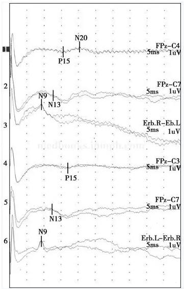 ��������������˫�����Ҳ�����12�죬���֫��鶯1��