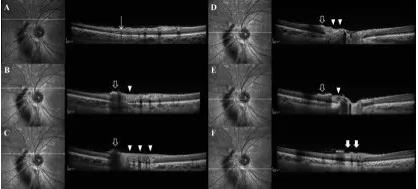 ��۴�ѧ�ۿ�ѧϵ���������輤��������������۵�����