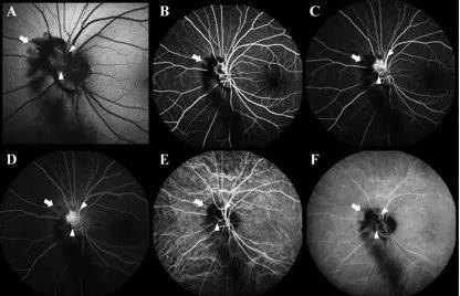 ��۴�ѧ�ۿ�ѧϵ���������輤��������������۵�����