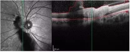 ��۴�ѧ�ۿ�ѧϵ���������輤��������������۵�����