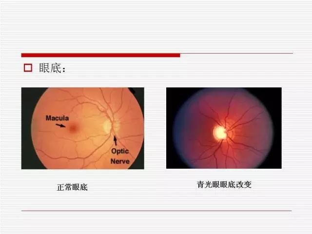 ��ȫ�������ؽ��⣨pptͼ�İ棩