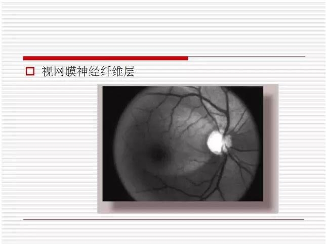 ��ȫ�������ؽ��⣨pptͼ�İ棩