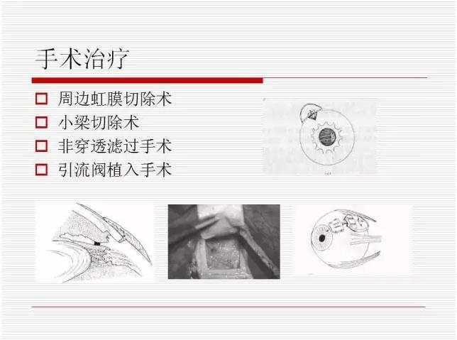 ��ȫ�������ؽ��⣨pptͼ�İ棩