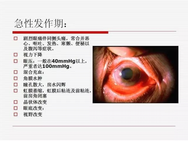 ��ȫ�������ؽ��⣨pptͼ�İ棩