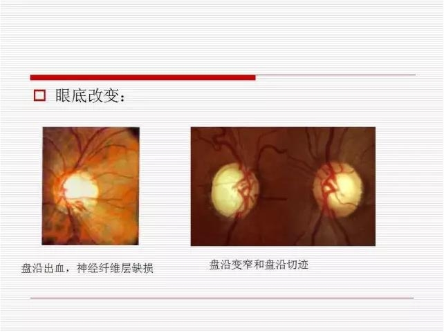 ��ȫ�������ؽ��⣨pptͼ�İ棩