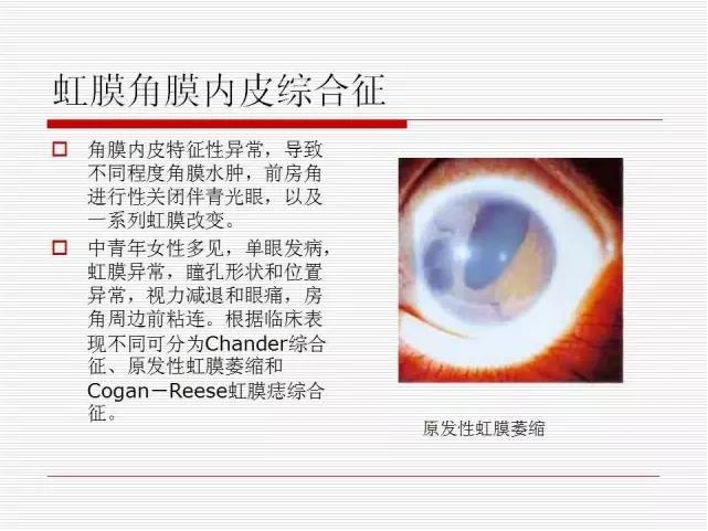 ��ȫ�������ؽ��⣨pptͼ�İ棩