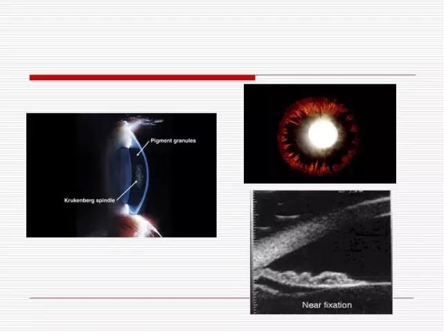 ��ȫ�������ؽ��⣨pptͼ�İ棩
