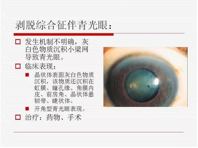 ��ȫ�������ؽ��⣨pptͼ�İ棩