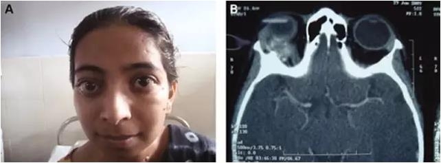 ��������ԭ���Լ�״���ٹ��ܿ����鵥������ͻ��