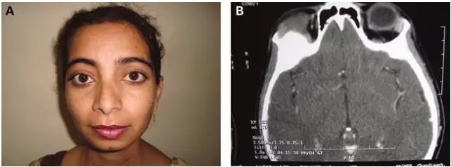 ��������ԭ���Լ�״���ٹ��ܿ����鵥������ͻ��