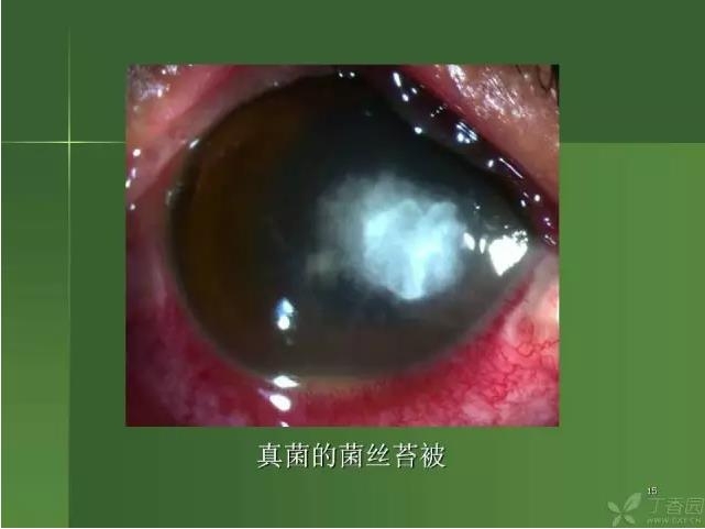 ����������Խ�Ĥ�׵ĸ��廯�ۺ����� ���ϣ�