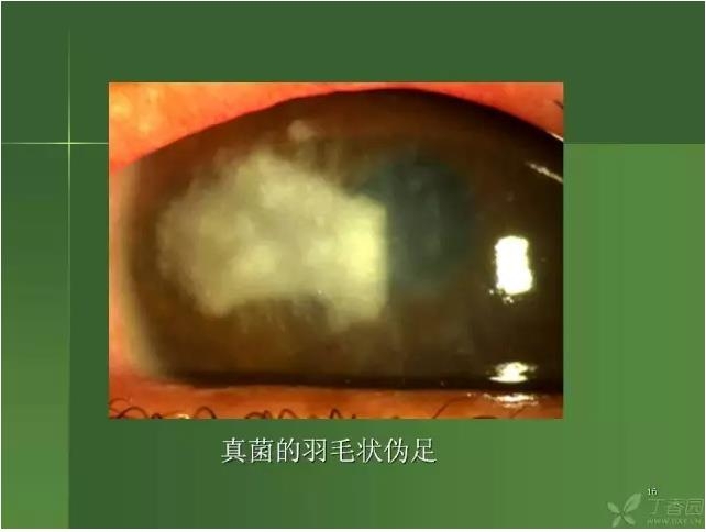 ����������Խ�Ĥ�׵ĸ��廯�ۺ����� ���ϣ�