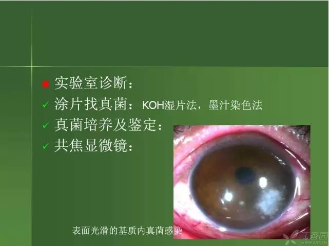 ����������Խ�Ĥ�׵ĸ��廯�ۺ����� ���ϣ�