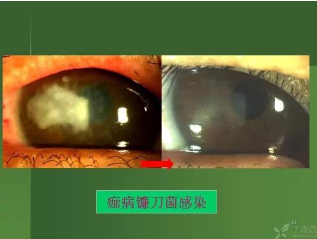 ����������Խ�Ĥ�׵ĸ��廯�ۺ����� ���ϣ�