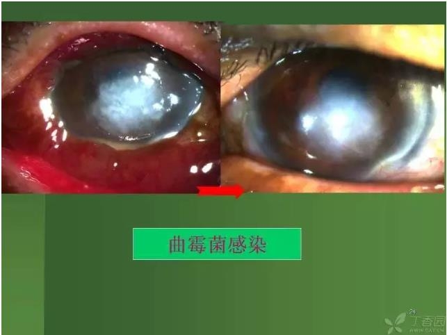 ����������Խ�Ĥ�׵ĸ��廯�ۺ����� ���ϣ�