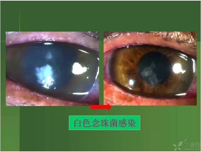 ����������Խ�Ĥ�׵ĸ��廯�ۺ����� ���ϣ�