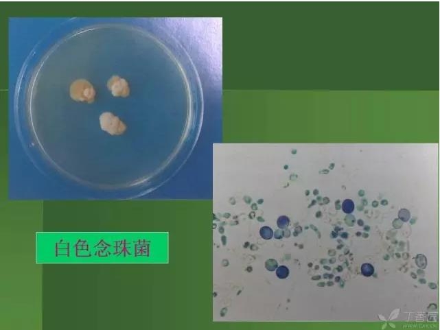 ����������Խ�Ĥ�׵ĸ��廯�ۺ����� ���ϣ�