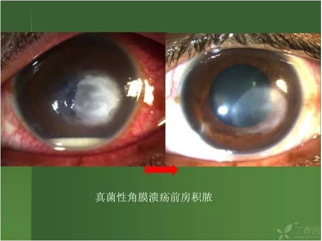 ����������Խ�Ĥ�׵ĸ��廯�ۺ����� ���£�