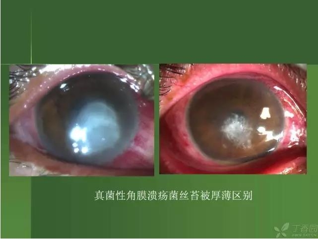 ����������Խ�Ĥ�׵ĸ��廯�ۺ����� ���£�